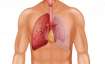 A crucial step to enhancing pneumonia care